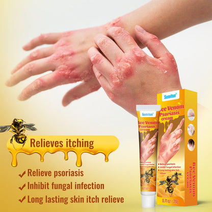 Summifun - Bee Venom Psoriasis Cream