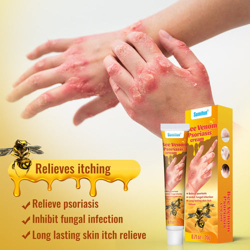 Summifun - Bee Venom Psoriasis Cream