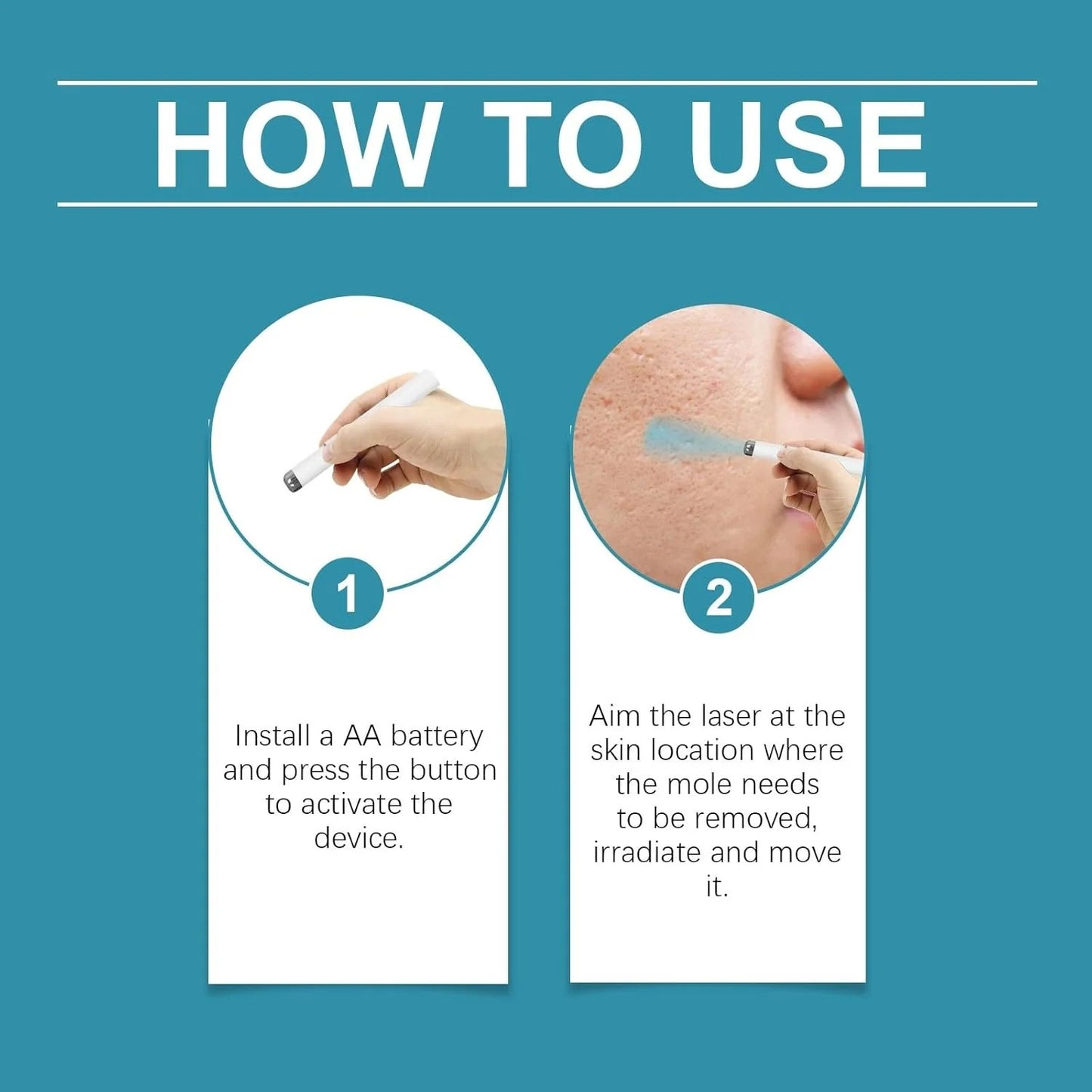 Xorita Non-Invasive Mole & Wart Removal Laser Pen